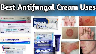 Best Common Antifungal Cream and Skin Ointment Names and Uses [upl. by Eednak280]