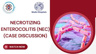 Necrotizing Enterocolitis NEC  Case Discussion [upl. by Quiteri]