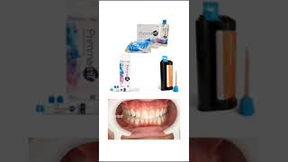 Bisacryl para puentes y coronas provisionales dentales [upl. by Eirehc]