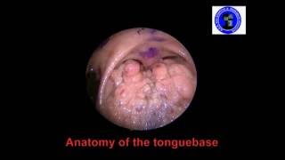 Anatomy of The Tongue Base [upl. by Cindee146]