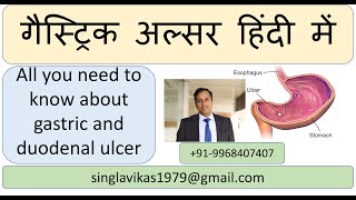 Gastric stomach and duodenum ulcer  Causes symptoms diagnosis and treatment by Dr Vikas Singla [upl. by Gnus225]