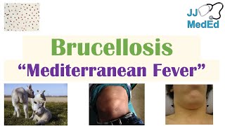 Brucellosis Mediterranean Fever  Transmission Pathogenesis Symptoms Diagnosis Treatment [upl. by Lidda738]