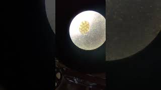 Tapeworm egg in dogs Dipylidium caninum pt2 parasite dogs tapeworm [upl. by Yetak]