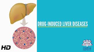 DrugInduced Liver Disease Causes Signs and Symptoms Diagnosis and Treatment [upl. by Onfroi874]