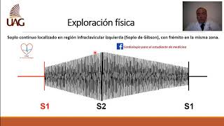 Persistencia del conducto arterioso [upl. by Ahgiel189]