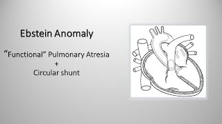 Ebstein anomaly quotfunctionalquot pulmonary atresia and quotcircularquot shunt [upl. by Htrowslle]