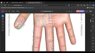 Pericardium meridian acu points practical [upl. by Nodnas666]