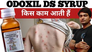 odoxil ds 250 mg syrup uses in hindi  odoxil ds 250 mg syrup uses in hindi  odoxil ds syrup [upl. by Nahsab]