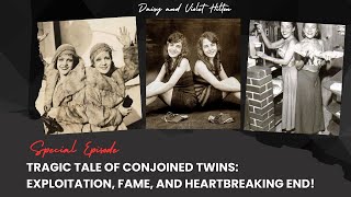 The intriguing story of Daisy and Violet Hilton Their story will move you [upl. by Ilujna763]