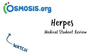 Herpes  Clinical Presentation [upl. by Maitund]