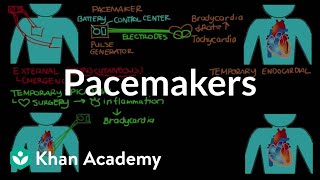 Pacemakers  Circulatory System and Disease  NCLEXRN  Khan Academy [upl. by Shevlo]