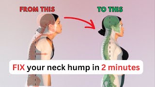 FIX neck hump with 2 minute exercise [upl. by Corwun]