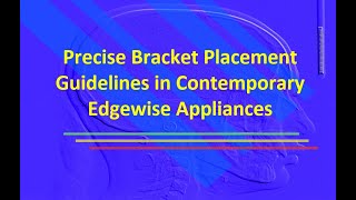 Precise Bracket Placement Guidelines in Contemporary Edgewise Appliances [upl. by Olathe342]