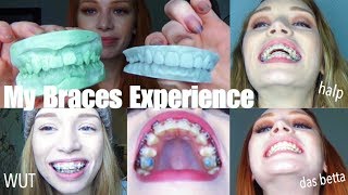 3 YEARS OF BRACES IN UNDER 30 MINS  VLOGstyle experience  transformation quotglowupquot [upl. by Avehs]