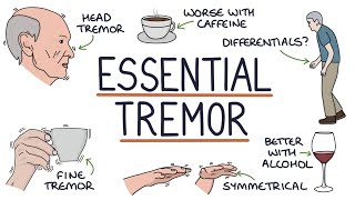 Understanding Benign Essential Tremor [upl. by Oiratno]