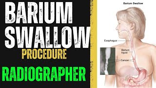 Barium Swallow Procedure  How to do Barium Swallow  Radiographer  X RAY Radiographer  Radiology [upl. by Ahsinawt24]