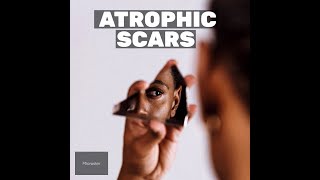 ATROPHIC SCARS [upl. by Larimer]