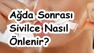 Ağda Sonrası Sivilce Nasıl Önlenir [upl. by Fiden]