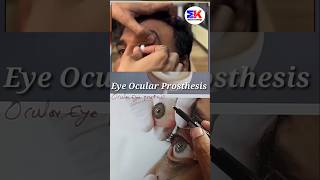 Eye Ocular Prosthesis shorts [upl. by Molini]