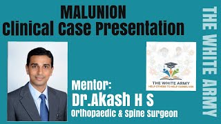 MALUNION Clinical Case Presentation [upl. by Modeerf]