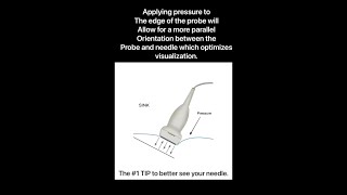 How to improve block needle visualization during ultrasound guided nerve block [upl. by Remington]