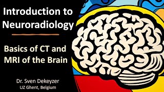 Basics of CT and MRI of the brain introduction to Neuroradiology [upl. by Telracs]