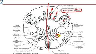 4 Closed medulla  motor decussation [upl. by Coraline328]