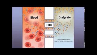 Hemodialysis Hemofilter and countercurrent animation [upl. by Lanaj]