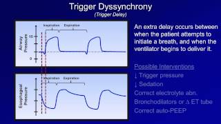 Pathologic Complications Mechanical Ventilation  Lecture 11 [upl. by Mayram]