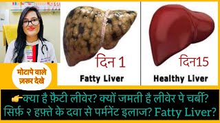 लीवेर पे चर्बी  Fatty Liver Disease Homeopathic Treatment Fatty liver Top Homeopathic Medicine [upl. by Yelrihs]