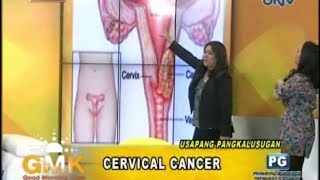 Understanding Cervical Cancer [upl. by Alanson]