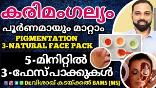 Natural remedy for pigmentation  കരിമംഗല്യം മാറാൻ 3 നാച്ചുറൽ ഫേസ് പാക്ക്Karimangalyam home remedy [upl. by Bird]