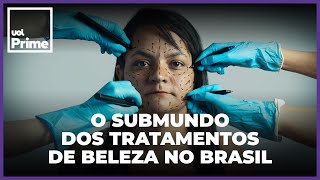 Do botox ao PMMA Brasil é paraíso de intervenções que são caso de polícia [upl. by Bough822]