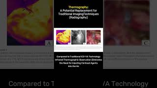 Experience the power of NonInvasive Healthcare with Thermography in Brain Surgeries medical [upl. by Erlond394]