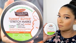 Palmers Cocoa Butter Tummy Butter for Stretch Marks  Did it really worked [upl. by Amre]