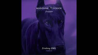 Madonna Vs Sickick  Frozen Fireboy DML Remix [upl. by Ydnor]