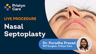 Deviated Septum Surgery  Endoscopic Septoplasty Explained  Pristyn Care [upl. by Ymmot630]