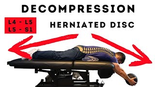 Best Decompression for lumbar herniated disc [upl. by Taddeo]