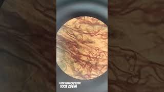 Histology Loose connective tissue under the Microscope  100X Zoom histologiedestissus muscle [upl. by Wincer935]