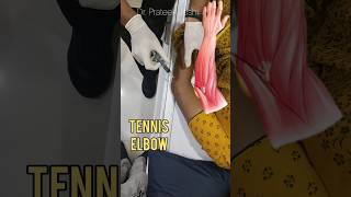 Tennis Elbow Steroid Injection  ortho elbow tenniselbow steroid injection [upl. by Earal]