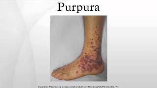 Purpura [upl. by Igenia]