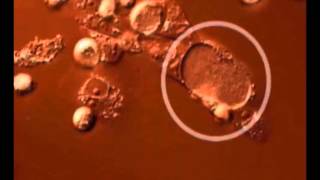 Time lapse video of the Chlamydia trachomatis developmental cycle [upl. by Yhtuv753]