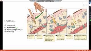 Enfermagem  PATOLOGIA  Reparo Tecidual [upl. by Liauqram]