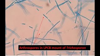 Arthroconidia of Trichosporon inkin Showing Long Cylindrical in Shape [upl. by Aicineohp457]