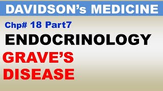 Davidsons Medicine Chp18 Part7  GRAVEs Disease  Endocrinology  Subclinical Thyroid Issues [upl. by Lonny193]