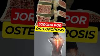 Síntomas Ocultos de OSTEOPOROSIS 😱 [upl. by Odie]