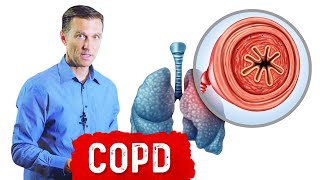 Chronic Obstructive Pulmonary Disease COPD [upl. by Rothstein982]