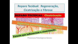 Reparo Tecidual Cicatrização [upl. by Thomson416]