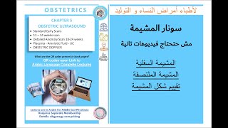 TOGIVEL Obstetrics  Chapter 5  Placenta ultrasound  سونار المشيمة بالتفصيل  Subscribe and LIKE [upl. by Valeria764]