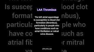 LAA Thrombus Cardiology echocardiogram echocardiography heartscan EGC medicine [upl. by Paff512]